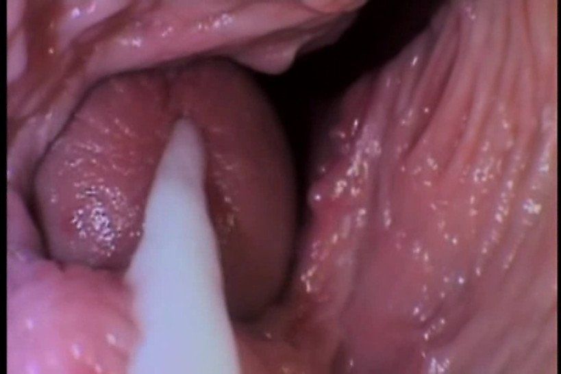 Inside vagina cam